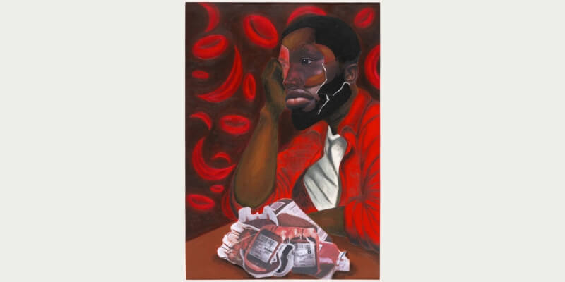 Nurses on the Frontline: A History of Sickle Cell - LECTURE